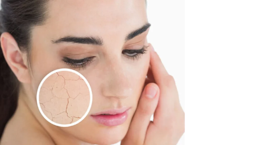 Ultimate Dry Skincare Routine: A Comprehensive Guide to Radiant Skin