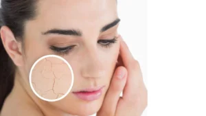 Ultimate Dry Skincare Routine